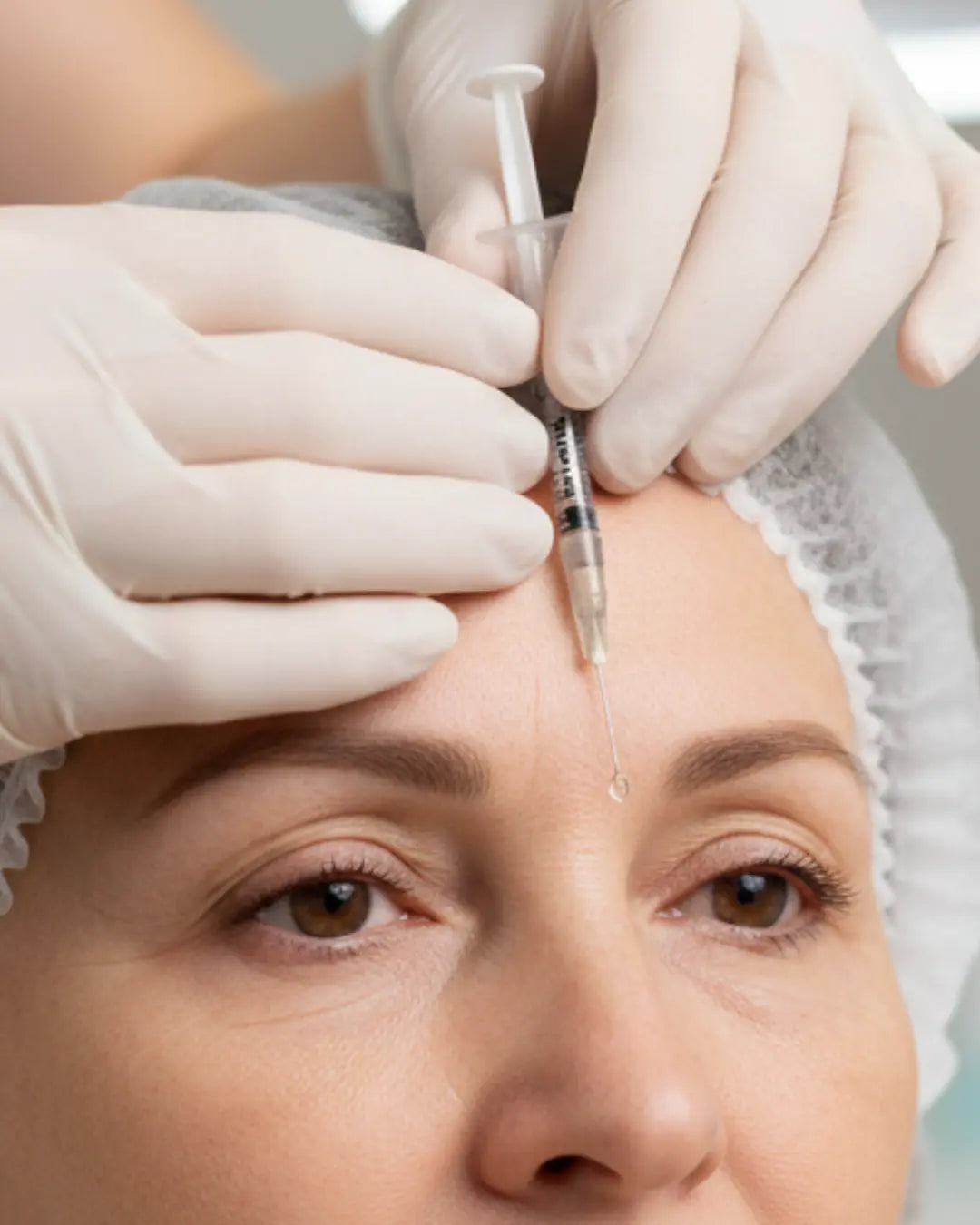 Botox Treatment